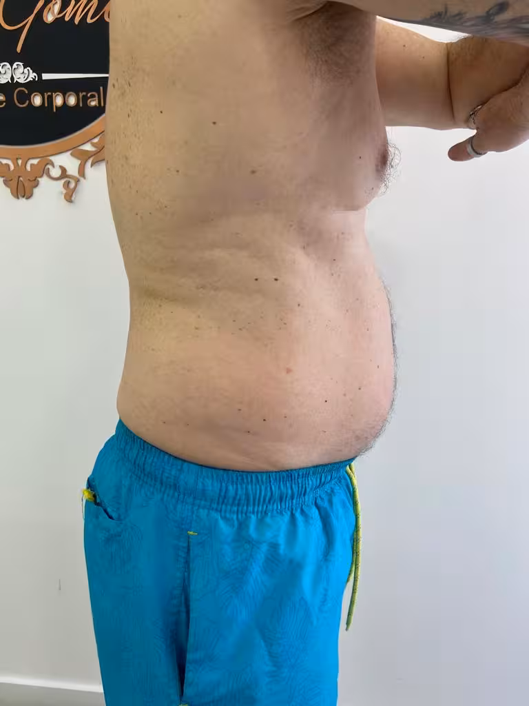 Antes - Crio da Josi