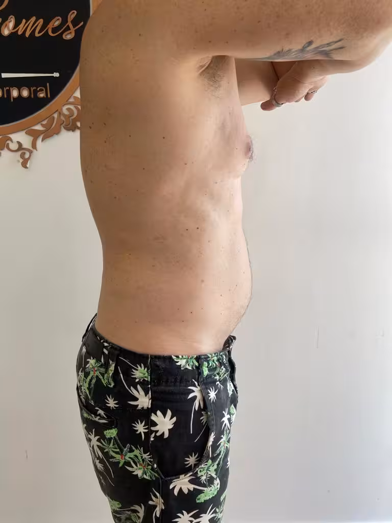 Depois - Crio da Josi